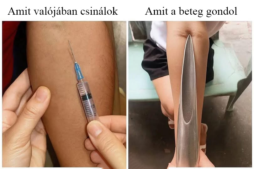Amikor a 23G tűt pallosnak látják